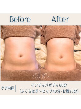 スー(Sue)/お腹before→after