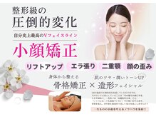 ラヴィ(Lavie)