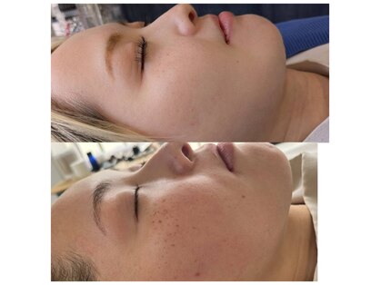 リノス(LinoS.)の写真