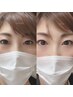 【頭痛軽減/小顔効果UP】La Luce式幹細胞ヘッドスパ＋フットマッサージ　60分