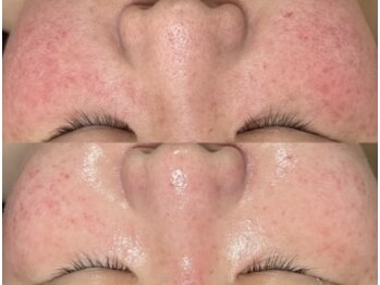 コア(Coeur)/befor→after