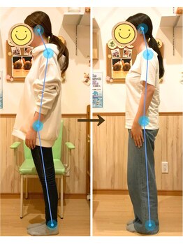 すぎうら整体院 浜松院/姿勢の変化