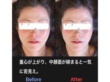 美容矯正サロン レレポノ(LELEPONO)/