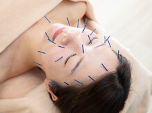 本厚木鍼灸整骨院の雰囲気（大人気美容鍼灸♪細胞活性化電機施術で、リフトアップを叶える◎）