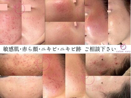サロンヴェアリー 広尾(salon vary)の写真