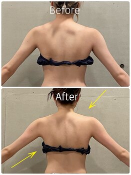 エクセレントビューティーサロン 艶(EN)/ブライダル１回