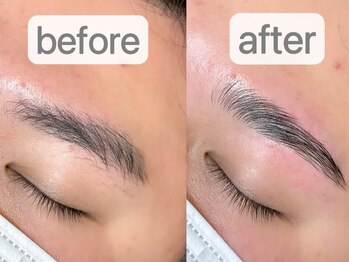 ティアマイレージ(TIA MILEAGE)/メンズハリウッドブロウリフト