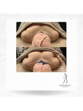 エレガンスアンドビューティー 船橋本店(Elegance&Beauty)/バストのボリュームアップ♪