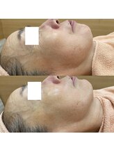 リッツ 大宮店/【Before/After】目元