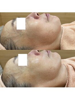 リッツ 大宮店/【Before/After】目元