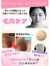 とくしま整体院 藍住院/毛穴ケア！！