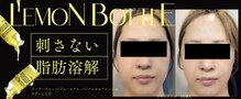 イチカエイト(ichica8)