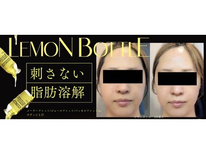 イチカエイト(ichica8)の写真