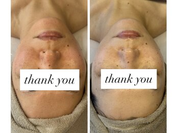 エマ(ema)/volayon韓国肌管理