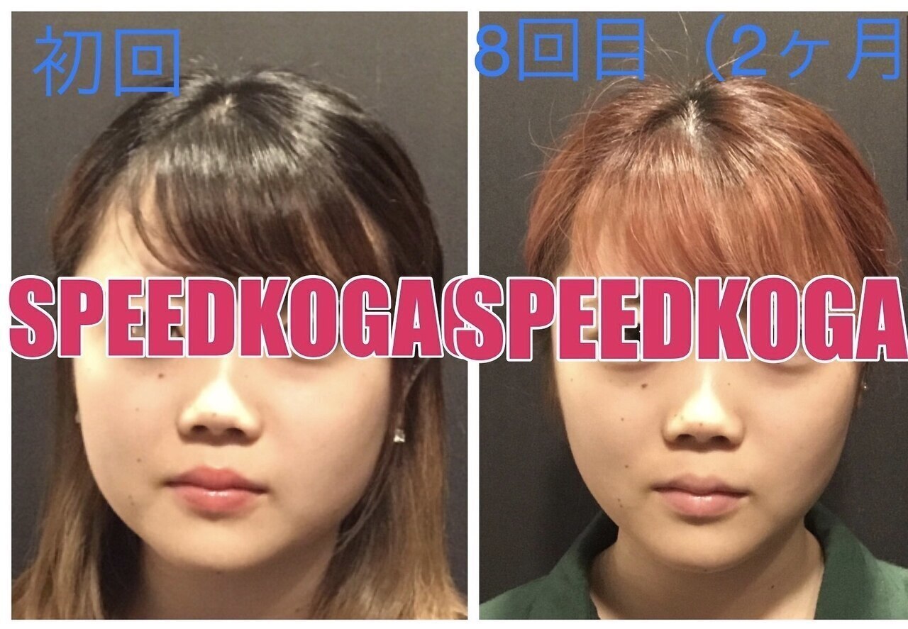 フォト｜スピード小顔 渋谷店 (Speed)｜ホットペッパービューティー