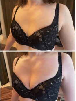 スマイルクルー(SmileClue)/ビフォーアフター症例