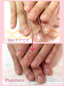 ネイルセラピーサロン プラムジュース(Nail Therapy Salon Plum Juice)/ネイルケア