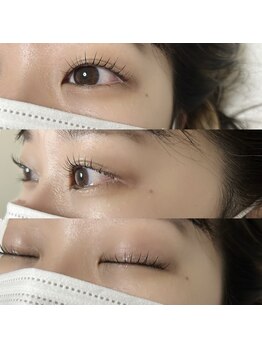 ペリドット(peridot)/SNSで話題メーテルロッド