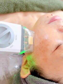ルキア(LUKIA)の写真/【効果実感率98%超え◎】二重あごタルミ改善に特化した専門家が施術☆お顔の脂肪・たるみに徹底アプローチ!
