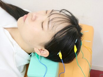 それいゆ鍼灸整骨院/+…施術風景…+　【美容鍼】