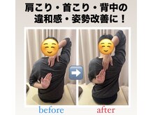 愛宕橋駅東口接骨院/肩甲骨はがしビフォーアフター
