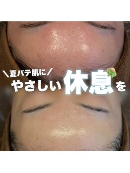 ジェノール 2nd beauty studio 姫路駅前店(JNOEL)/夏バテ肌に優しい休息を♪