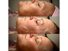 『ゾンビマスク』で張り、ツヤ、きめ細かさがよみがえります！