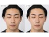 【産毛OFF】うるツヤ美肌WAX（全顔） マツヤニ配合WAX使用