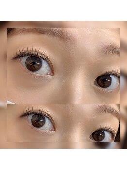 フロラ(Flora)/◇フラットマットラッシュ