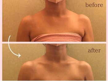 和 ゼンエニシ(Zen enishi)/ビフォーアフター～深層リンパ～