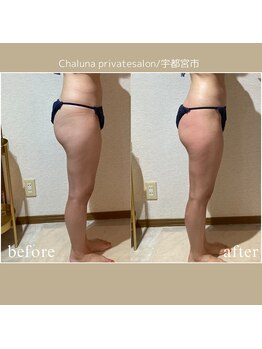 シャルナ(Chaluna)/1回でのフル集中ケア