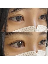 ルヴィ(Revi)/パリジェンヌラッシュリフト