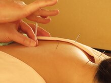 よもぎ堂 飯田橋/鍼灸/マッサージ/肩こり[飯田橋]