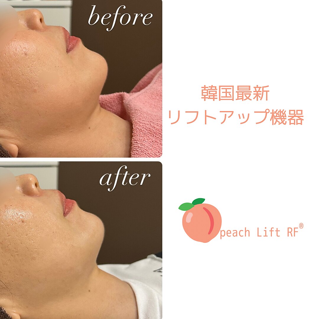 シーラックス(Sealax)｜ホットペッパービューティー