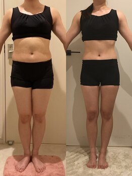 リツイート(ReTweet)/医療提携 二か月服用