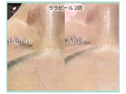 トリンテ バイ フェース(TRINTE by FAITH)の写真