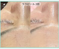 トリンテ バイ フェース(TRINTE by FAITH)