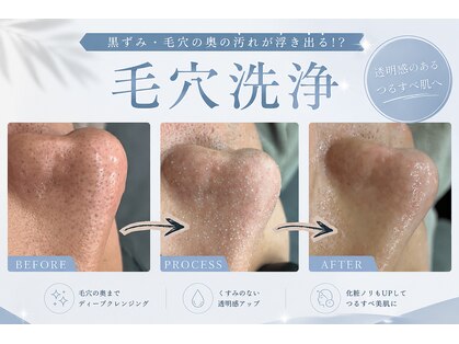 レベンディス(LEVENDIS)の写真