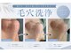 レベンディス(LEVENDIS)の写真