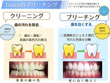 ドルチェ 水戸店(Dolce)の雰囲気（たった30分でホワイトニングケア。予約も取りやすく通いやすい♪）