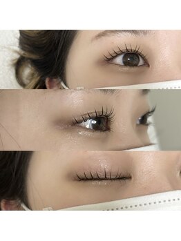 ペリドット(peridot)/SNSで話題メーテルロッド