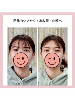 目元 口元のたるみ 眉間シワ改善専門サロン/クマ改善や細顔になりたい方向け