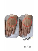 シーオングル(Siii ongle)/フットをしながらハンドマスク