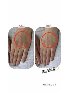 シーオングル(Siii ongle)/フットをしながらハンドマスク