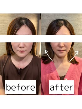 セント 江坂店(SCENT)/電気美容鍼