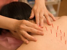 かすがい鍼灸院リハート(Re.heart)/自律神経の乱れを整えたい