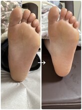 フロー(Froh)/全体的にガサガサ