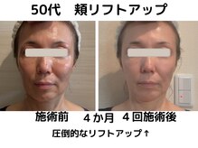 エンジェルエッグの雰囲気(【頬リフトアップ↑】頭皮リフトx顔筋リフトx高周波)