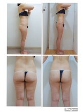 デイスパ ヴィータ/before after