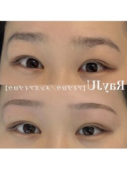 レイジュ(RayJU)/お客様の施術例【札幌